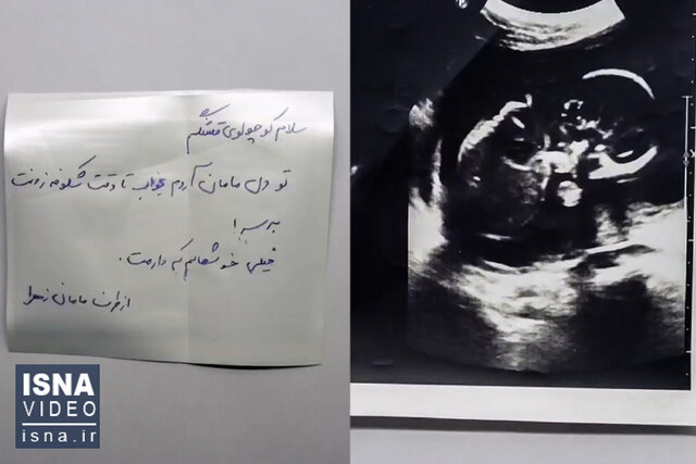 ویدئو / این صدای قلب فراموش نشدنی؛ زیباترین حس مادرانه ویدئو / این صدای قلب فراموش نشدنی؛ زیباترین حس مادرانه