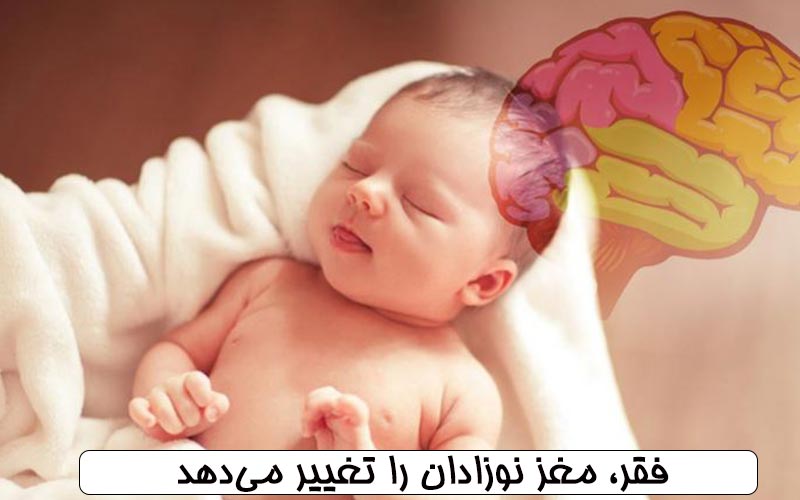 فقر، مغز نوزادان را تغییر می‌دهد !