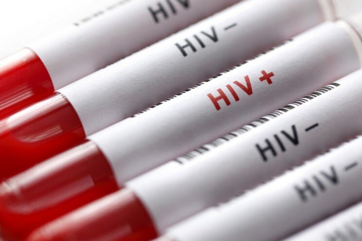 تقابل امید و ترس در نبرد با HIV