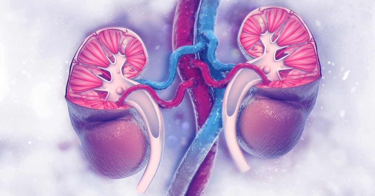 هیدرونفروز؛ از عوامل و علائم بیماری تا راهکارهای موثر پیشگیری