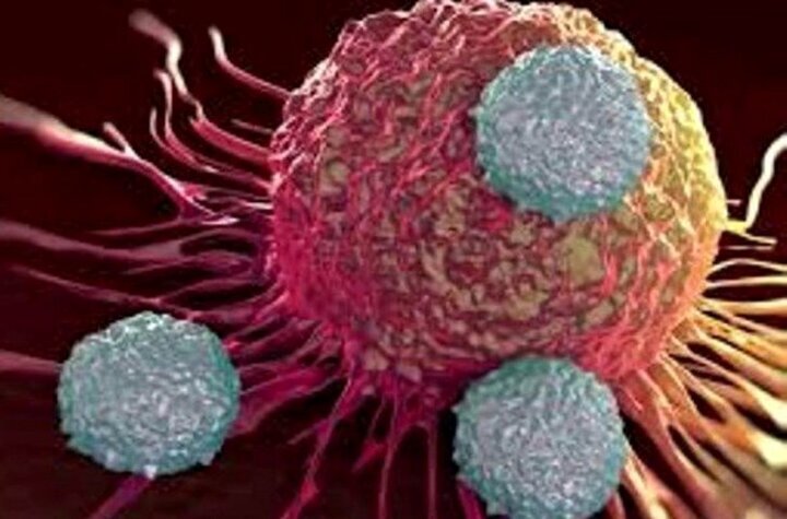 اما و اگرهای تکرار پرتودرمانی در بیماران مبتلا به سرطان 2 اما و اگرهای تکرار پرتودرمانی در بیماران مبتلا به سرطان