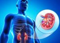علائم اولیه مشکلات کلیوی کدام است؟ 3 علائم اولیه مشکلات کلیوی کدام است؟