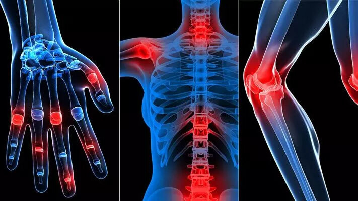 چگونه می‌توان درد مفاصل را با طب سنتی درمان کرد؟