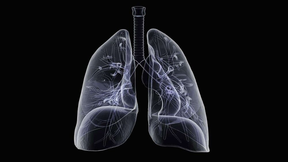 ذاتالریه یا پنیومونی چیست؟ | علائم، علل و روشهای درمانی برای پیشگیری و بهبودی سریع 2 ذاتالریه یا پنیومونی چیست؟ | علائم، علل و روشهای درمانی برای پیشگیری و بهبودی سریع