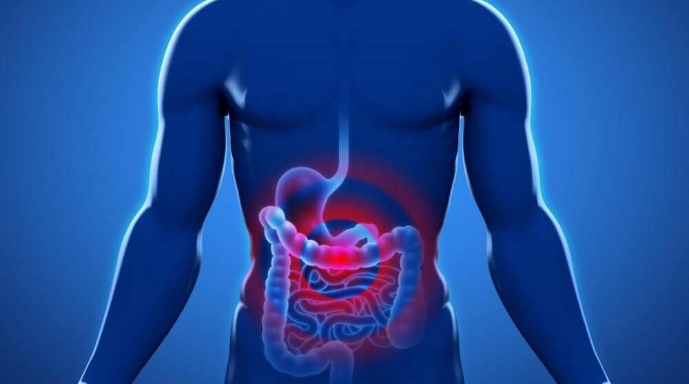 از گوشت قرمز تا کمتحرکی؛ عوامل پنهان افزایش خطر سرطان روده بزرگ 2 از گوشت قرمز تا کمتحرکی؛ عوامل پنهان افزایش خطر سرطان روده بزرگ