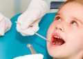 دندان‌های شیری؛ حلقه‌ای فراموش‌شده در زنجیره سلامت کودک